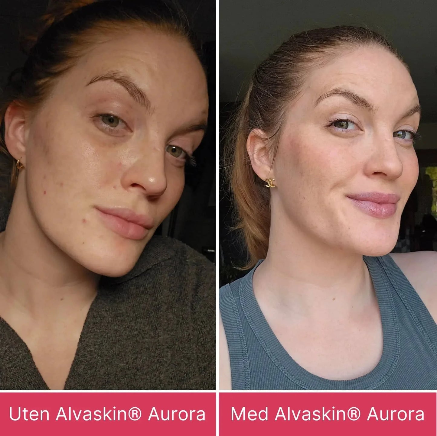 Alvaskin® Aurora