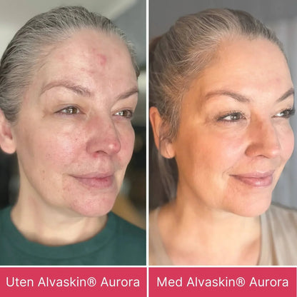 Alvaskin® Aurora